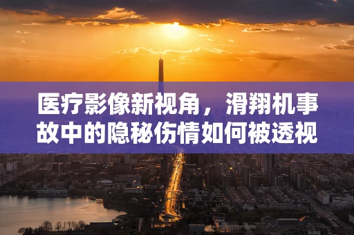 医疗影像新视角，滑翔机事故中的隐秘伤情如何被透视？