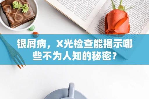 银屑病，X光检查能揭示哪些不为人知的秘密？